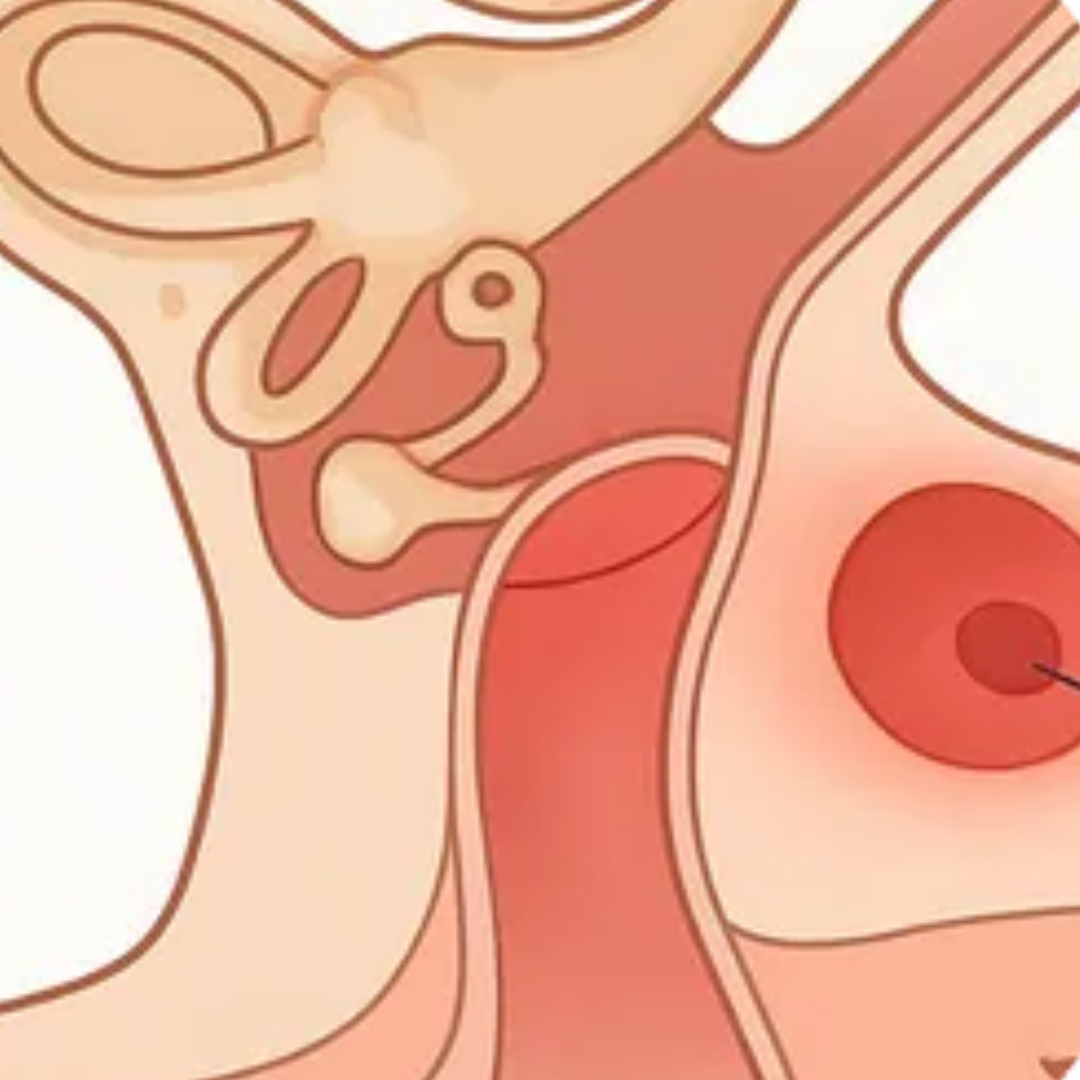 Repeated ear infections