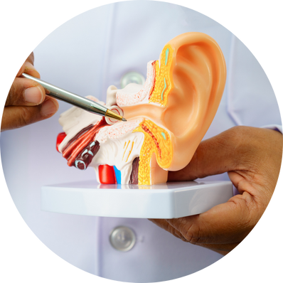 Eardrum repair with partial ossicle involvement