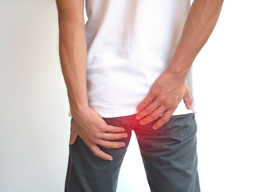 Anal Fissure