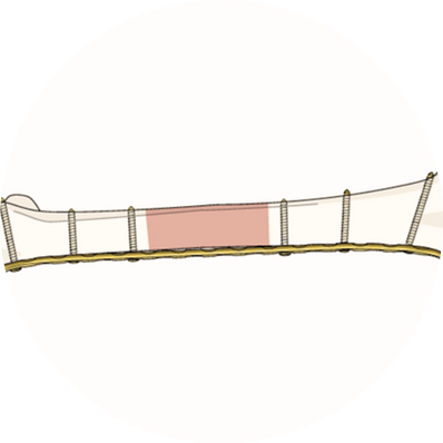 Bridge Plating
