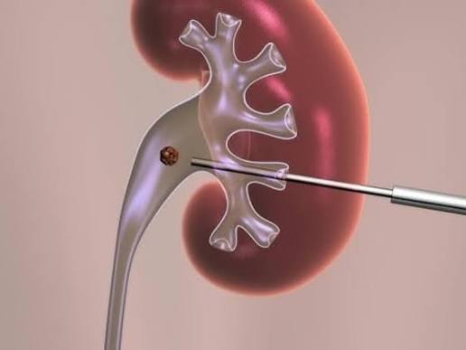 Urology