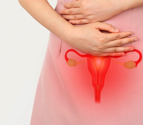 Pelvic inflammatory disease (PID)