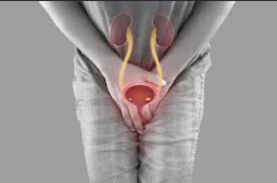 Recurrent urinary infections