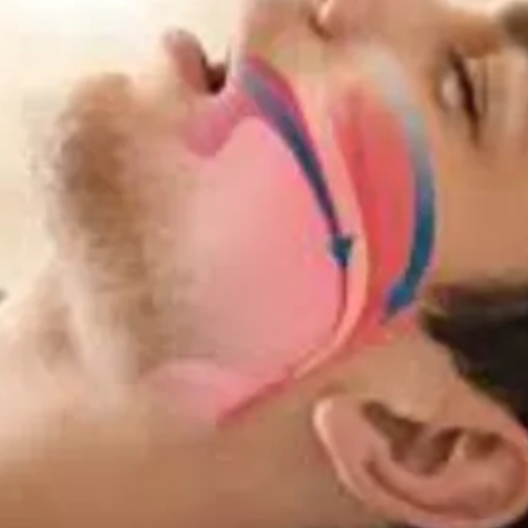 Mouth breathing or snoring