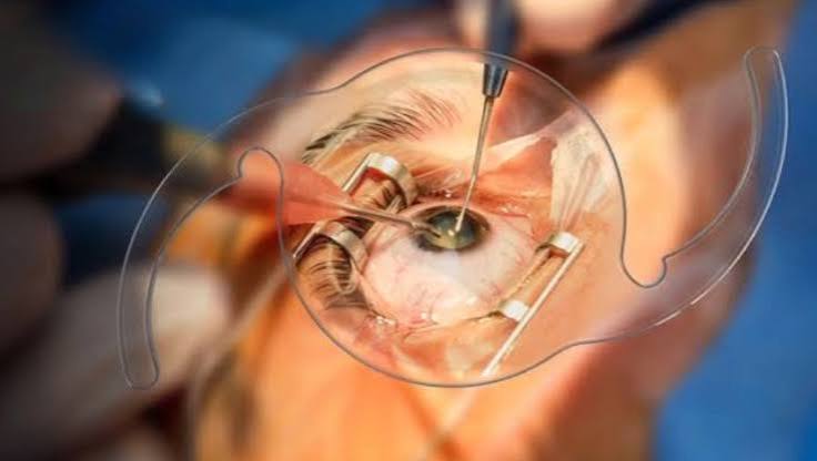 Ophthalmology