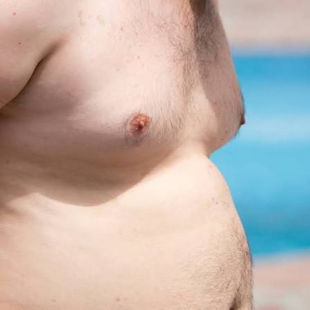 Asymmetrical chest appearance