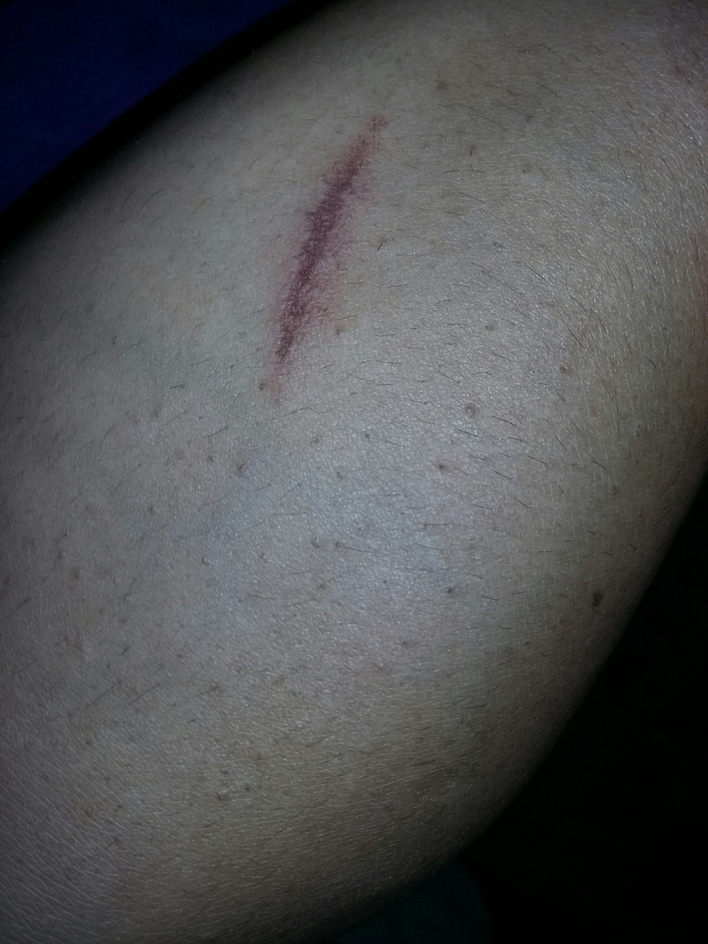 No visible scars
