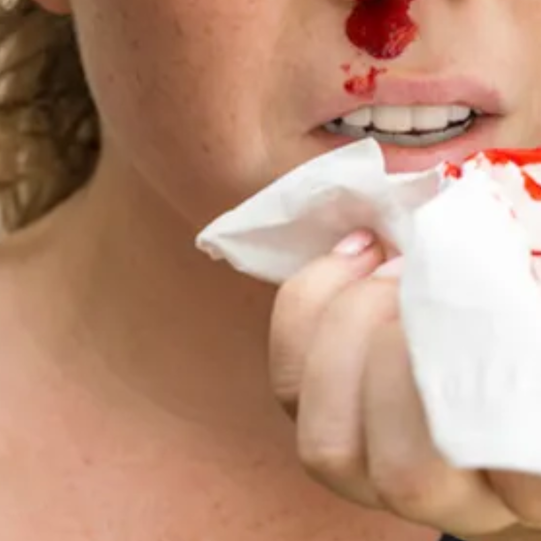 Frequent nosebleeds
