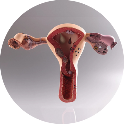 Abnormal uterine bleeding