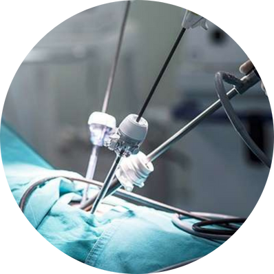 Operative laparoscopy