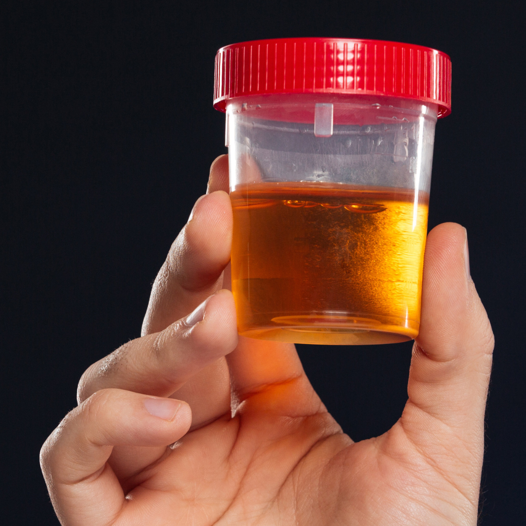 Blood in urine