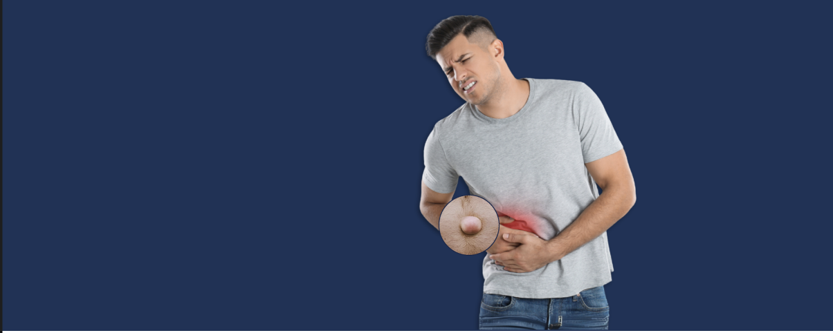 Hernia Repair Surgery (Laparoscopic Mesh Repair)