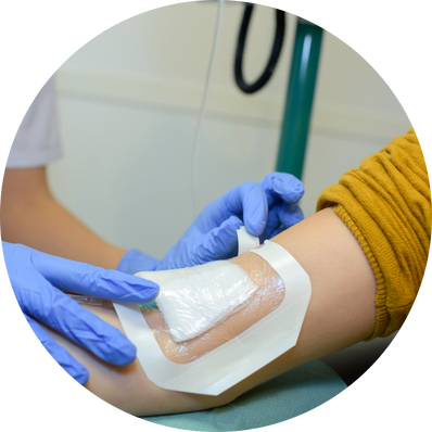 Autolytic Debridement