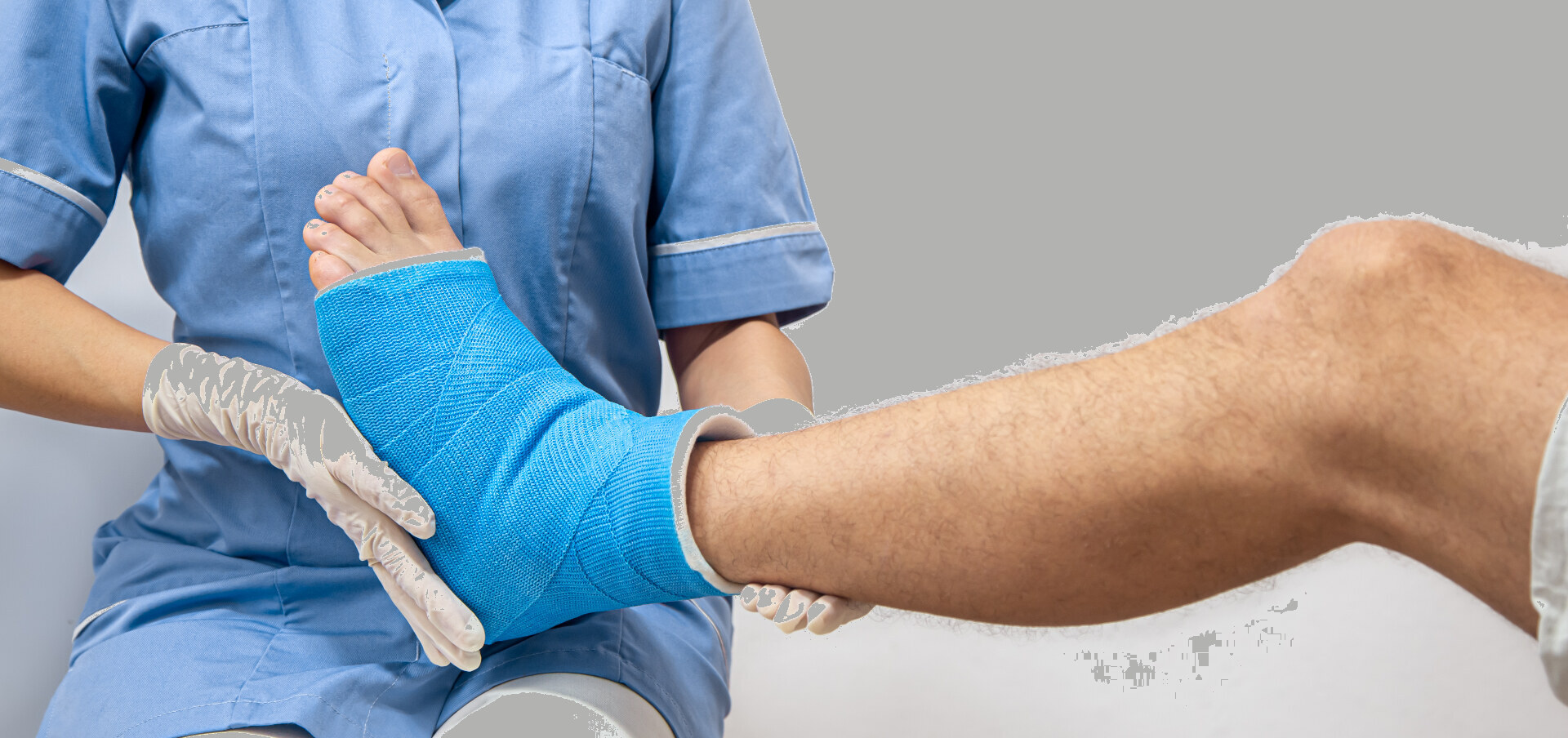 Fracture Fixation (Open Reduction & Internal Fixation)