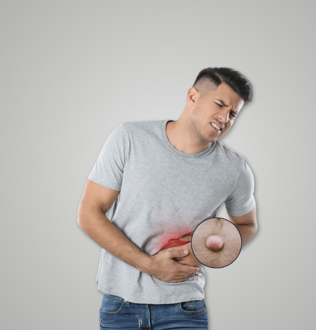 Hernia Repair